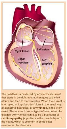 Image result for Pacemaker X-ray Algorithm