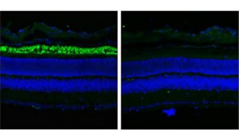Anti-ABCA4 Antibody, clone TMR1 clone TMR1, from mouse | Sigma-Aldrich