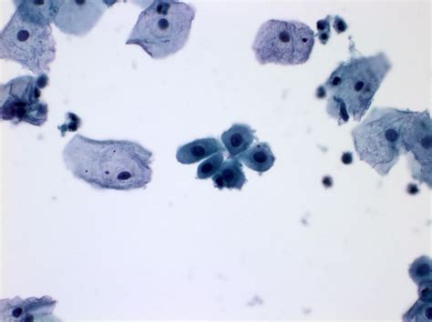 Pathology Outlines - Normal and nonneoplastic findings