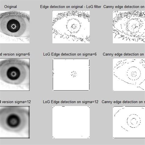 Image result for Perform Edge Detection Using the Laplacian of the Gaussian in Python