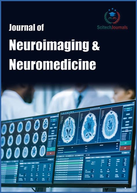 Editorial board | Journal of Neuroimaging and Neuromedicine