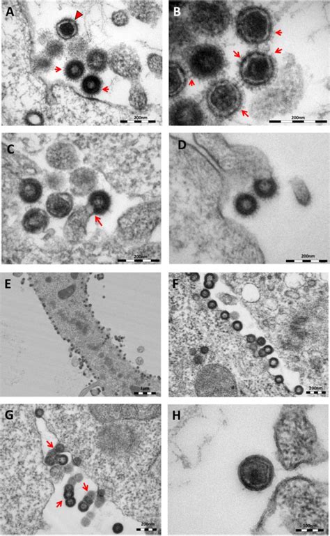Viruses | November 2014 - Browse Articles