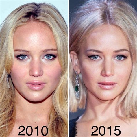 Jennifer Lawrence did mention that she had a nose job done, not for ...