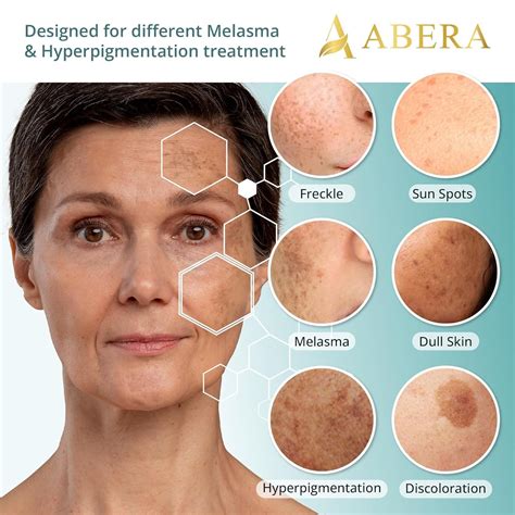 Best Oral Supplements For Melasma - Serene Skin Health