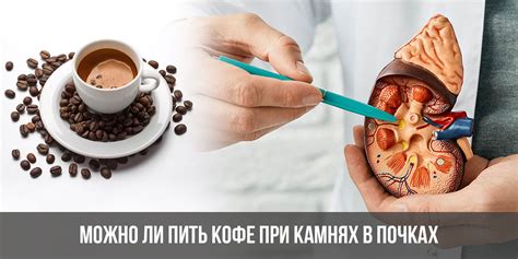 Можно ли пить кофе при камнях в почках | при мочекаменной болезни