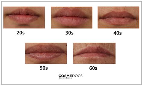 What Do Vertical Lips Meaning | Lipstutorial.org