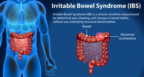 Irritable Bowel Syndrome Ibs Symptom Causes Symptom White Stool