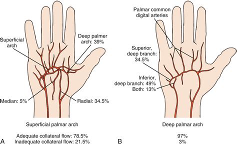 Vascular Disorders of the Hand - Clinical Tree