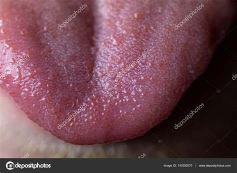 Bump Tip Tongue