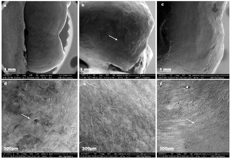 Toothpaste Composition Effect on Enamel Chromatic and Morphological ...