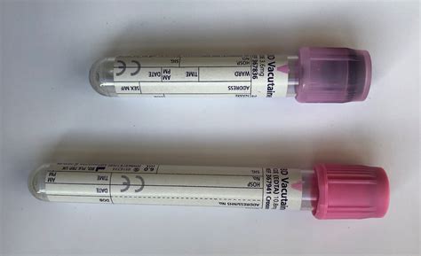 C-Peptide Exeter Clinical Laboratory International