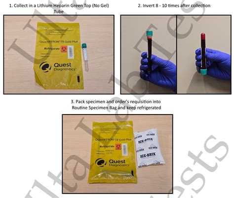 QuantiFERON®-TB Gold Plus Tuberculosis Test | Ulta Lab Tests