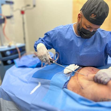 CoolSculpting Vs Liposuction: 9 Expert-Backed Differences Explained - OJAN Beauty Company Limited