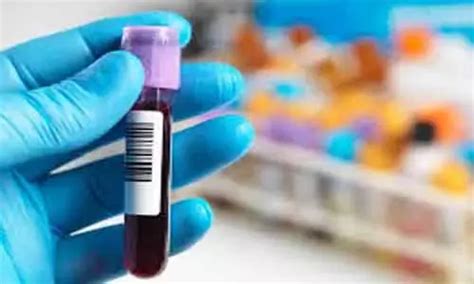 New test may help in early diagnosis of Cushing's Syndrome: Frontiers