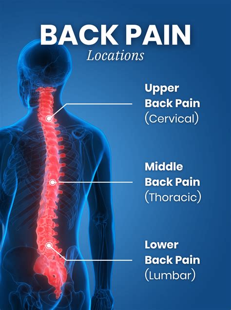 Most Common Upper Back Muscle Injuries - Infoupdate.org