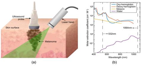 Photoacoustic/Ultrasound/Optical Coherence Tomography Evaluation of ...