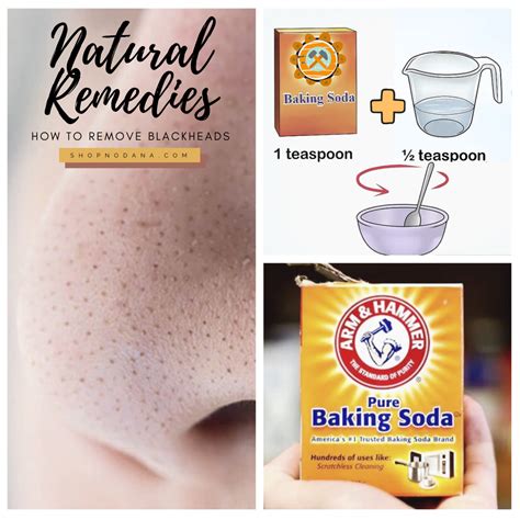 How to Remove Blackheads on Nose- Natural Ways - Shopno Dana