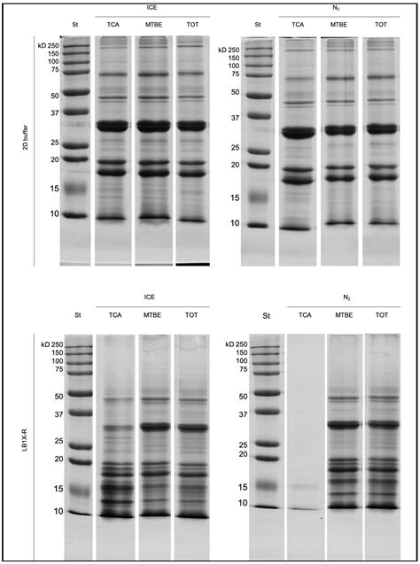 What You Extract Is What You Get: Different Methods of Protein ...
