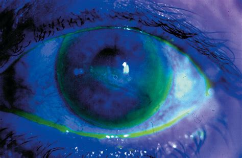 Therapeutic Applications - Clinical Tree