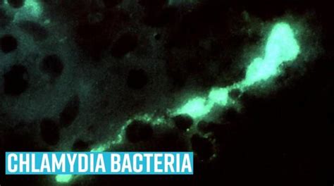 Israeli scientists develop world's 1st mRNA vax for deadly bacteria ...
