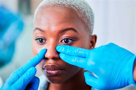 Rinoplasty (NOSE) - Go Surgery Tijuana