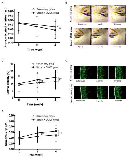 Enhanced Micro-Channeling System via Dissolving Microneedle to Improve ...