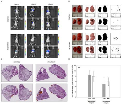 Melatonin-Induced Cytoskeleton Reorganization Leads to Inhibition of ...