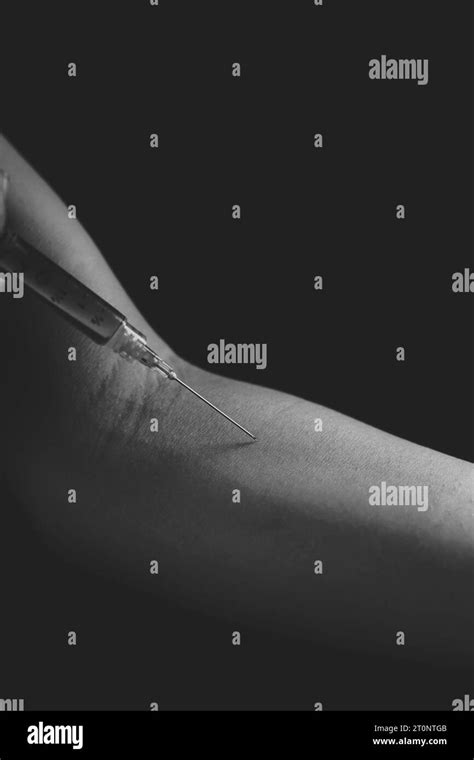 Arm Injection 的图像结果