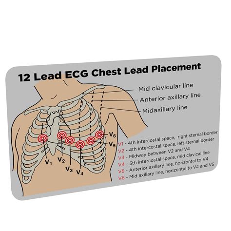 Ecg Leads View Of Common ECG Lead Placement Errors. Part I: Limb Lead