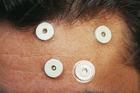 Computer Surgery 的图像结果