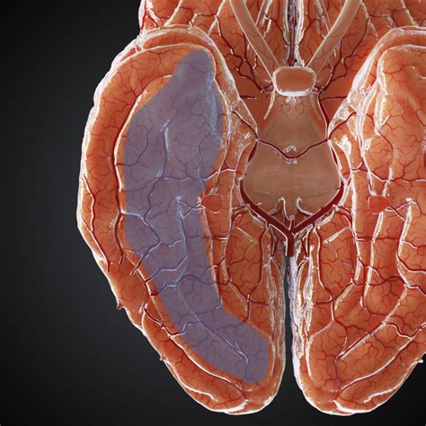 Transverse Temporal Gyrus Anatomy