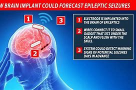 Epileptic 的图像结果