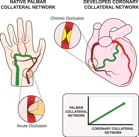 Collateral Circulation Lower Extremity