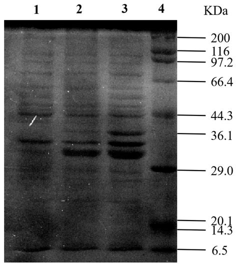 Characterization of Feruloyl Esterase from Klebsiella oxytoca Z28 and ...