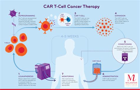 Λευκαφαίρεση για παραγωγή & θεραπεία με CAR-T cells - Δρ. Ηλίας Πέσσαχ - Αιματολόγος