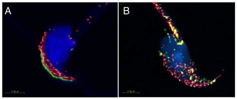 CD9 and CD81 Interactions and Their Structural Modelling in Sperm Prior ...