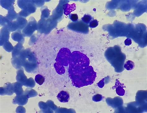 Hematopoiesis - howitreat.in