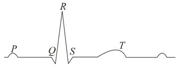Given below is the ECG of a normal human. Which one of its components ...