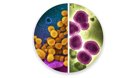 Is it COVID or the flu? As cases rise, here's how symptoms differ