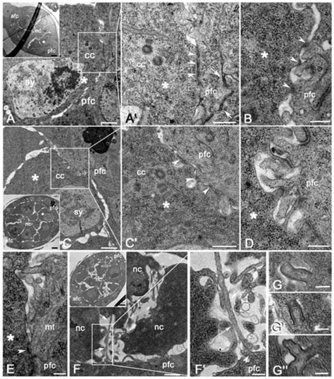 Cell-to-Cell Interactions during Early Drosophila Oogenesis: An ...