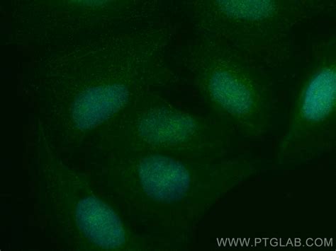 NCKAP5 antibody (31199-1-AP) | Proteintech