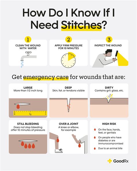 When To Get Stitches