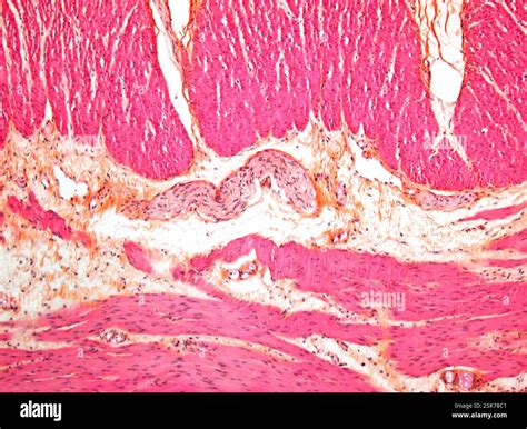 Micrographie lumineuse d'une section de la paroi élargie du gros ...