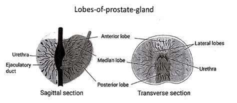 Prostate Gland: Miscellaneous - Medical Science Optional Notes for UPSC ...