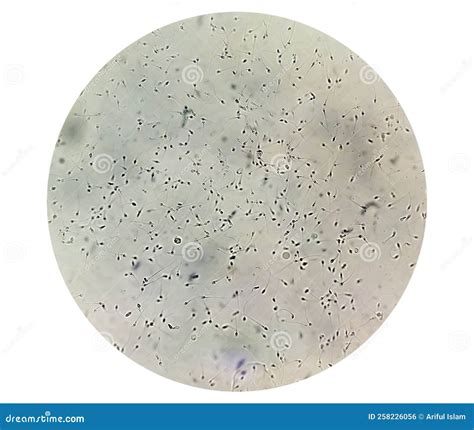 Sperm Microscope 40x