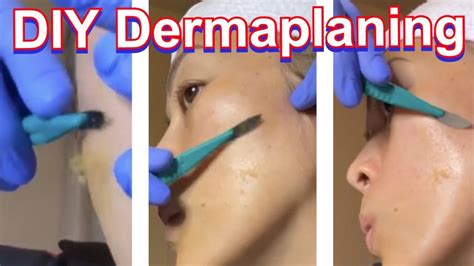 Image result for Dermaplaning Tutorial