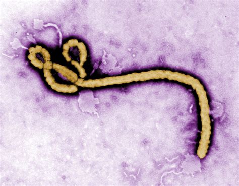 現曙光！沖繩大學解開伊波拉病毒「結構的秘密」 有望開發新藥 | ETtoday國際新聞 | ETtoday新聞雲