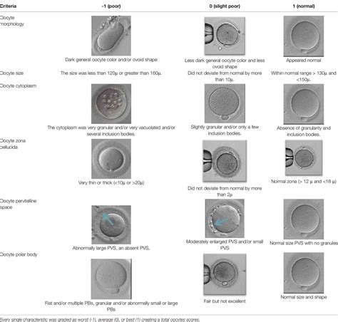 Frontiers | PCOS and Role of Cumulus Gene Expression in Assessing Oocytes Quality