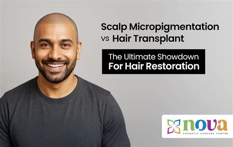 Scalp Micropigmentation vs Hair Transplant: The Ultimate Showdown for ...