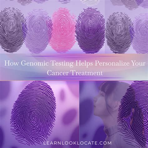 Paget's Disease of the Breast: Symptoms, Diagnosis, Treatment